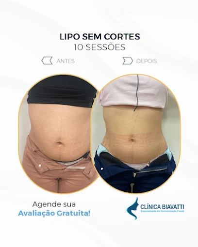 Resultado antes e depois de harmonização facial na Clínica Biavatti, Maringá